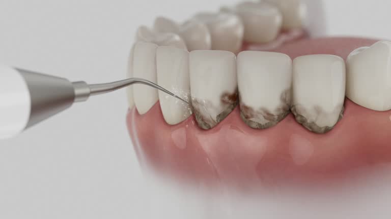 Reliable Dental contractor in Locust Fork, AL by Smile Center Dentistry